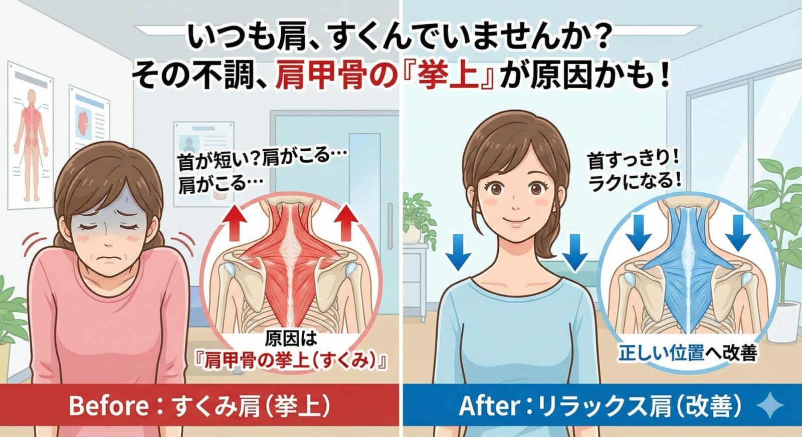 「首が短くなった」と感じたら｜肩こり・頭痛と“肩甲骨の上がりすぎ”の関係と見直し方
